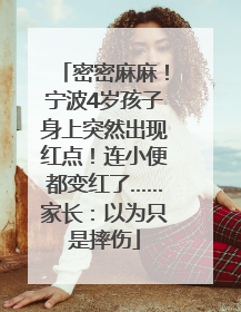 密密麻麻！宁波4岁孩子身上突然出现红点！连小便都变红了……家长：以为只是摔伤