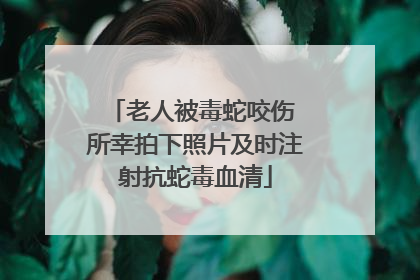 老人被毒蛇咬伤 所幸拍下照片及时注射抗蛇毒血清